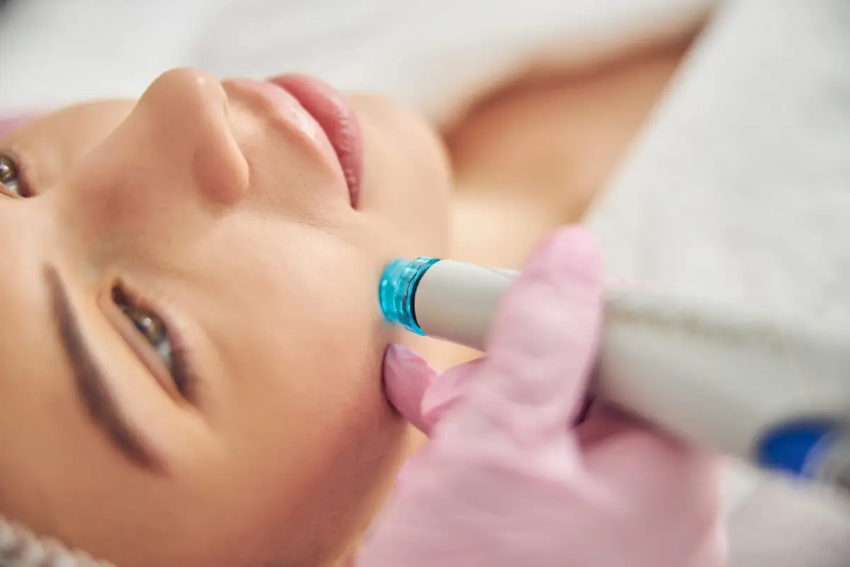 Hydrodermabrasion near me