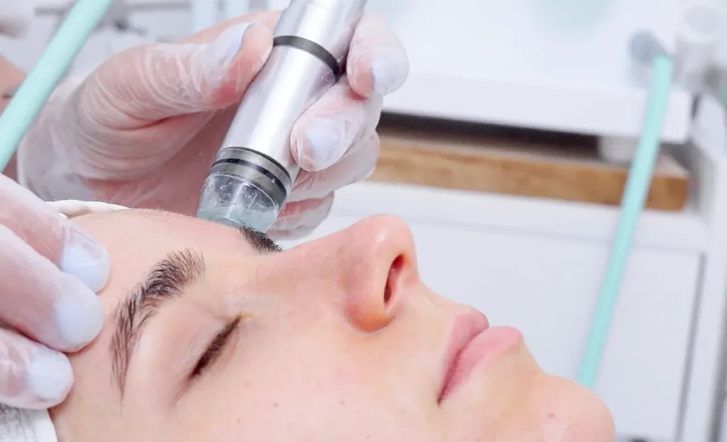 Hydrodermabrasion near me